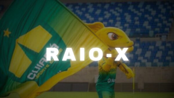RAIO-X (1)